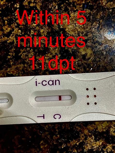 faint positive after 10 minutes.